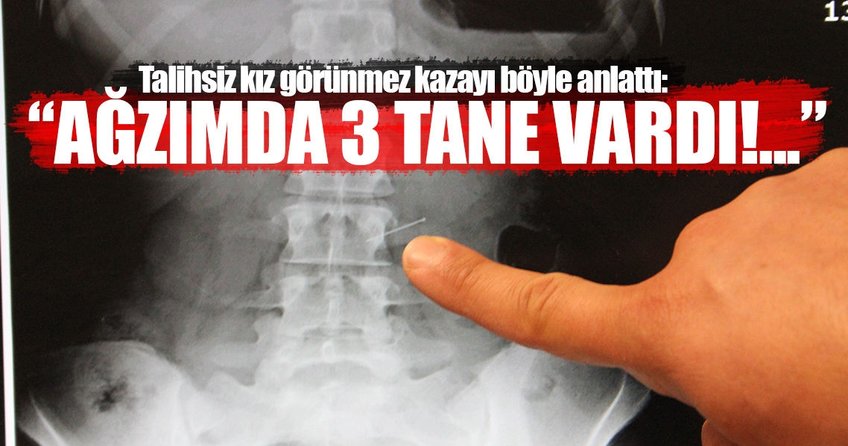 Başörtüsü takarken iğne yuttu