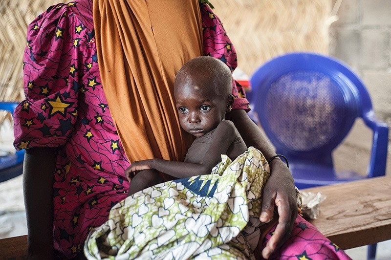  A young girl suffering from malnutrition sitting on her mother's lap, in the Muna informal settlement, which houses nearly 16,000 internally displaced people, northeastern Nigeria, 30 June, 2016. (AFP Photo)
