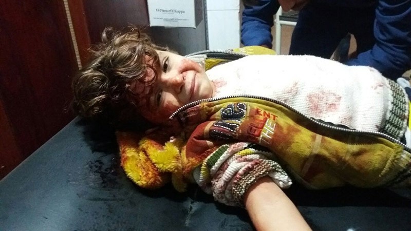 Injured child after Syrian government shelling that hit kindergarten. 