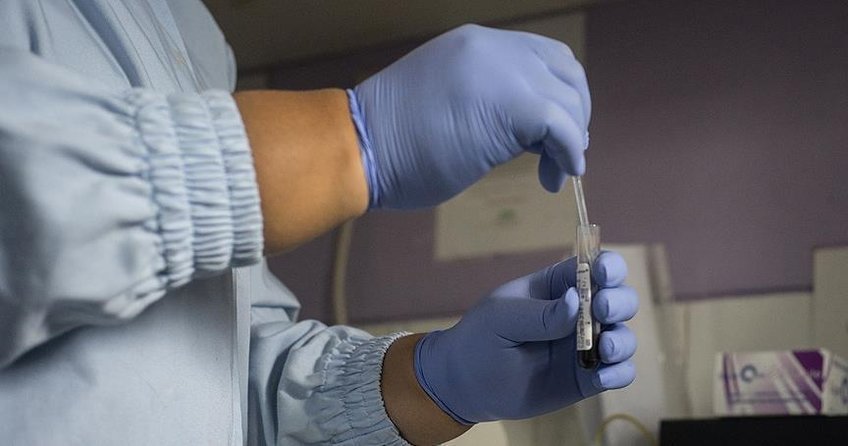 Hindistanda sahte doktor 21 kişiye AIDS bulaştırdı