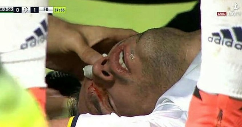 Van Persie ile yan yana tedavi oldu, formayı kaptı
