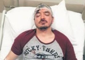 Ünlü sanatçı Orhan Ölmez komşuları tarafından beş yerinden bıçaklandı