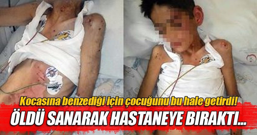 Kocasına benzediği için öz evladını bu hale soktu!