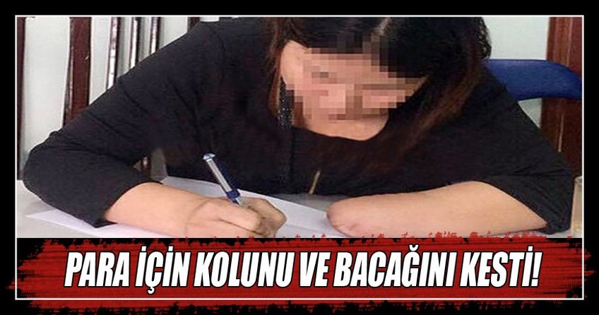 Vietnamlı kadın para için kolunu ve bacağını kesti