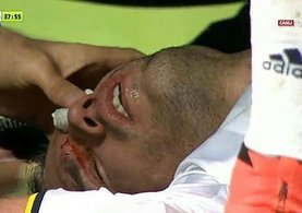 Van Persie ile yan yana tedavi oldu, formayı kaptı