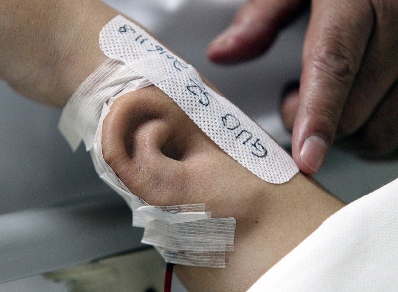 An ,ear, is seen growing on the forearm of a patient who lost his organ in an accident. (Reuters Photo)