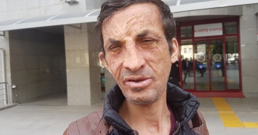 Türkiye’nin ilk yüz nakli olan Uğur Acar hakim karşısına çıktı