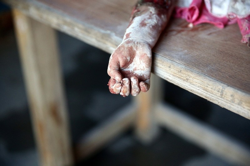 The hand of a dead child is pictured after shelling in the rebel held besieged town of Douma, eastern Ghouta in Damascus, Syria October 20, 2016. (REUTERS Photo)
