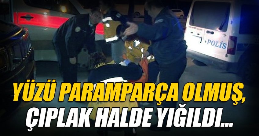 Yüzü paramparça olmuş, çıplak halde yığıldı..