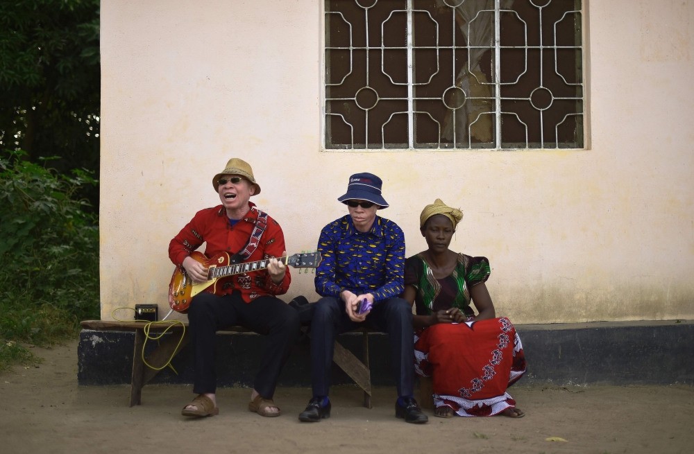 Albino singer King Shube (L) plays a guitar on Ukerewe Island.