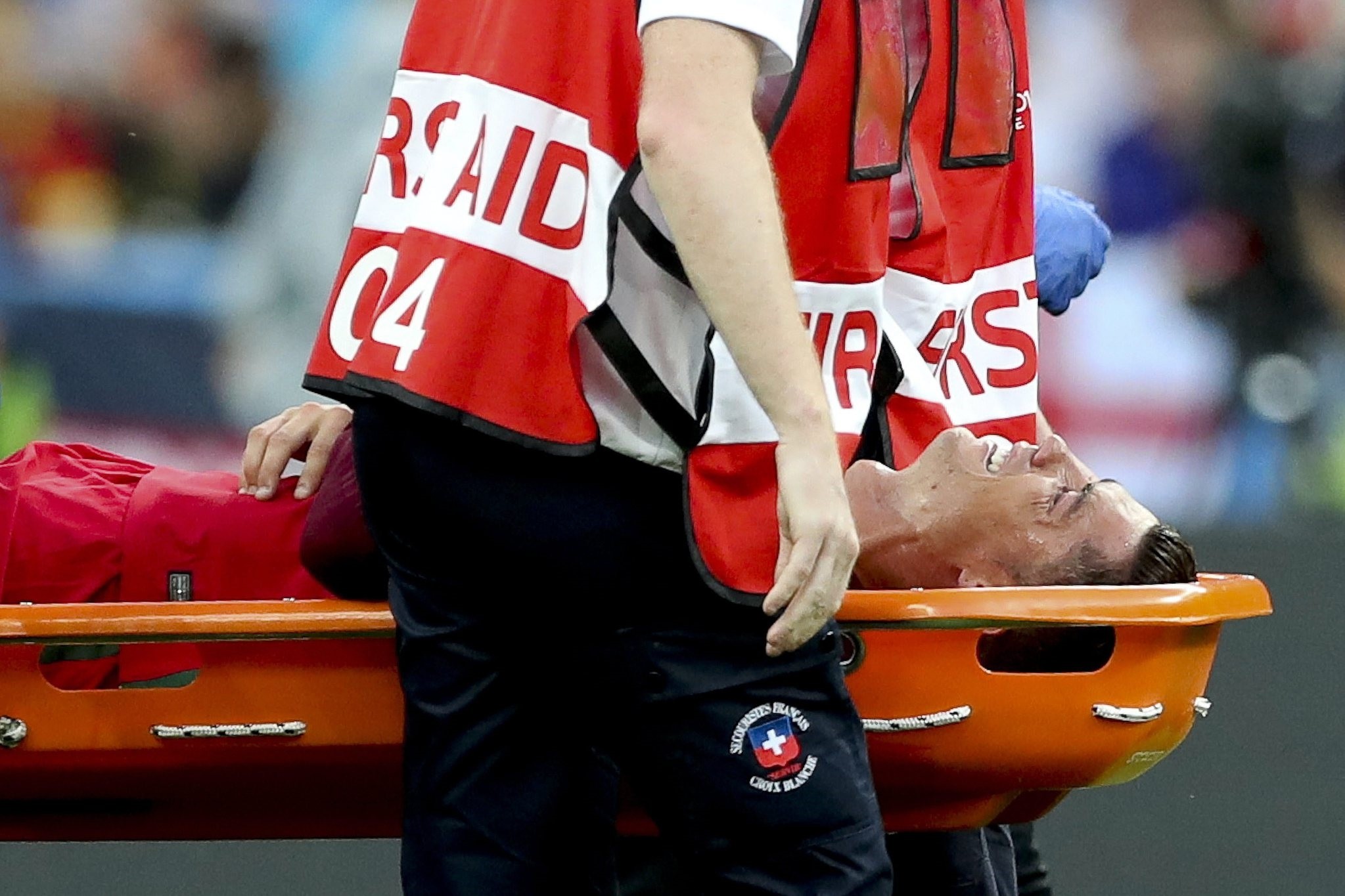 Cristiano Ronaldo of Portugal is stretchered off the pitch after being injured during the UEFA EURO 2016 Final match between Portugal and France at Stade de France in Saint-Denis, France, 10 July 2016. (EPA Photo)