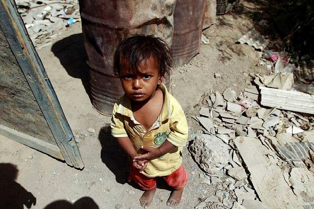 Yemeni children face life-threatening malnutrition, lack of access to health care and clean water due to the war.