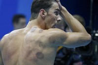 Michael Phelps (USA) of USA is seen with red cupping marks on his shoulder as he competes. (REUTERS Photo)