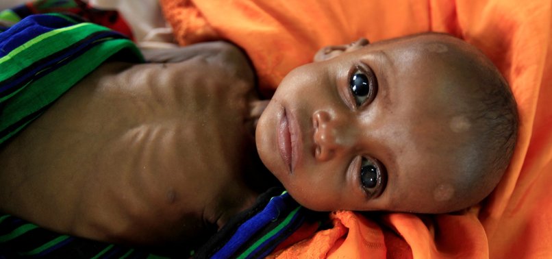 AFRICA’S HUMANITARIAN CRISES WORSEN: UN