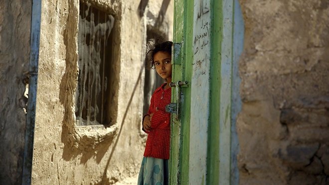 AÇLIK 13 MİLYON İNSANI TEHDİT EDİYOR!