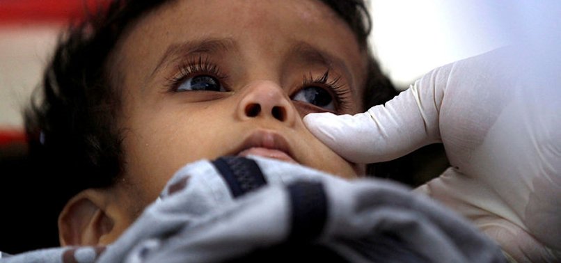 AID GROUP: 85,000 CHILDREN MAY HAVE DIED OF HUNGER IN YEMEN