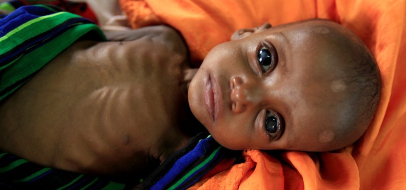TURKEY TO SEND 15,000 TONS OF AID TO DROUGHT-RIDDEN SOMALIA