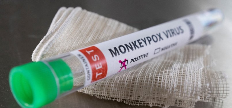 CHINA REPORTS MONKEYPOX CASE
