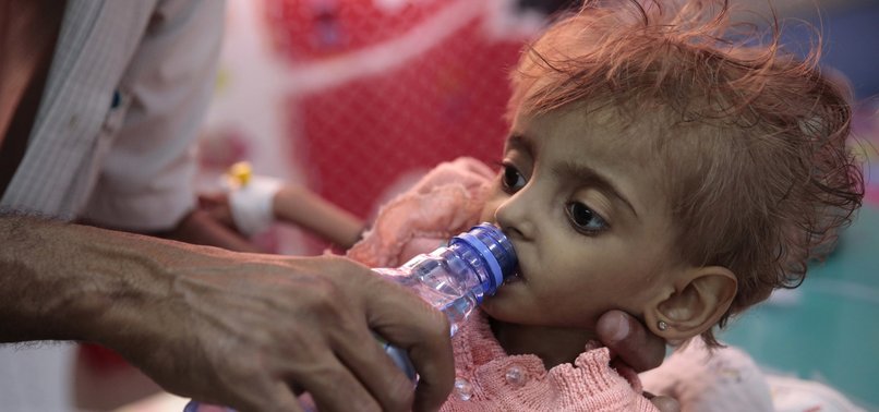 WFP TO RESUME FOOD AID TO YEMENIS AFTER LONG DELAYS