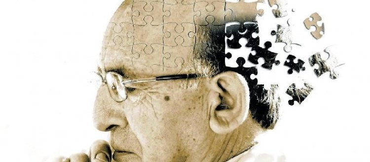 Alzheimer beyne 25 yıl öncesinde yerleşiyor