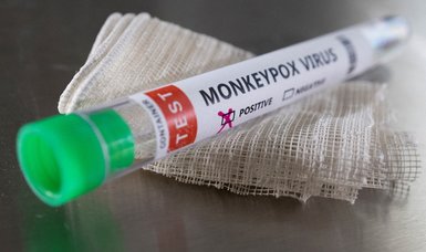 China reports monkeypox case