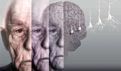 Expert highlights natural aging process and impact on sensory organs