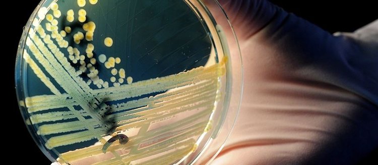 ’2050’de antimikrobiyal direnç her yıl 10 milyon can alabilir’