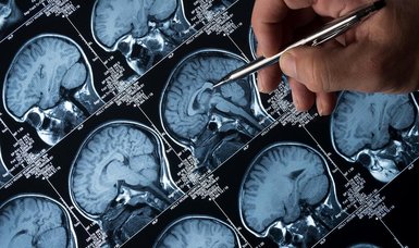 New alzheimer's drug 