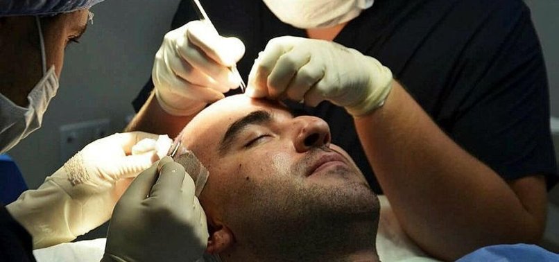 TOP-CLASS TREATMENT MAKES TURKEY HAIR TRANSPLANT HOTSPOT