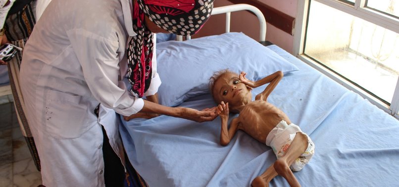 UN AID CHIEF: FIGHT AGAINST FAMINE IS BEING LOST IN YEMEN