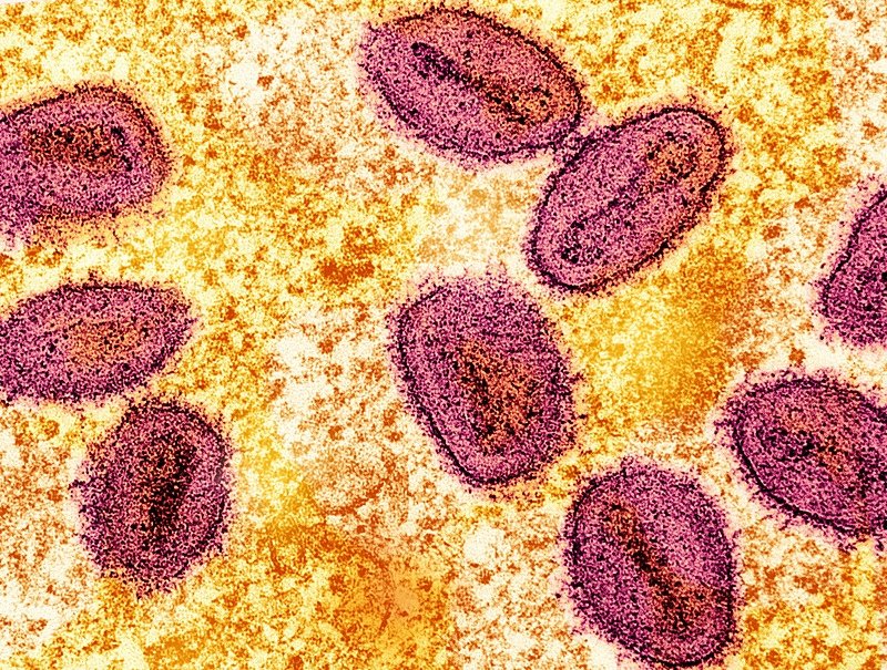 Photo Gallery | MPOX Guide: Here are transmission routes, symptoms, and ...