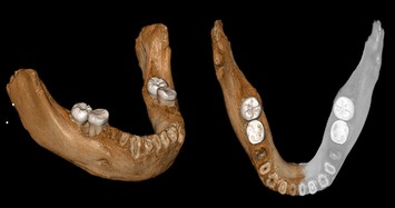 Jawbone fossil of Denisovans, mysterious extinct humans, found in Tibet cave