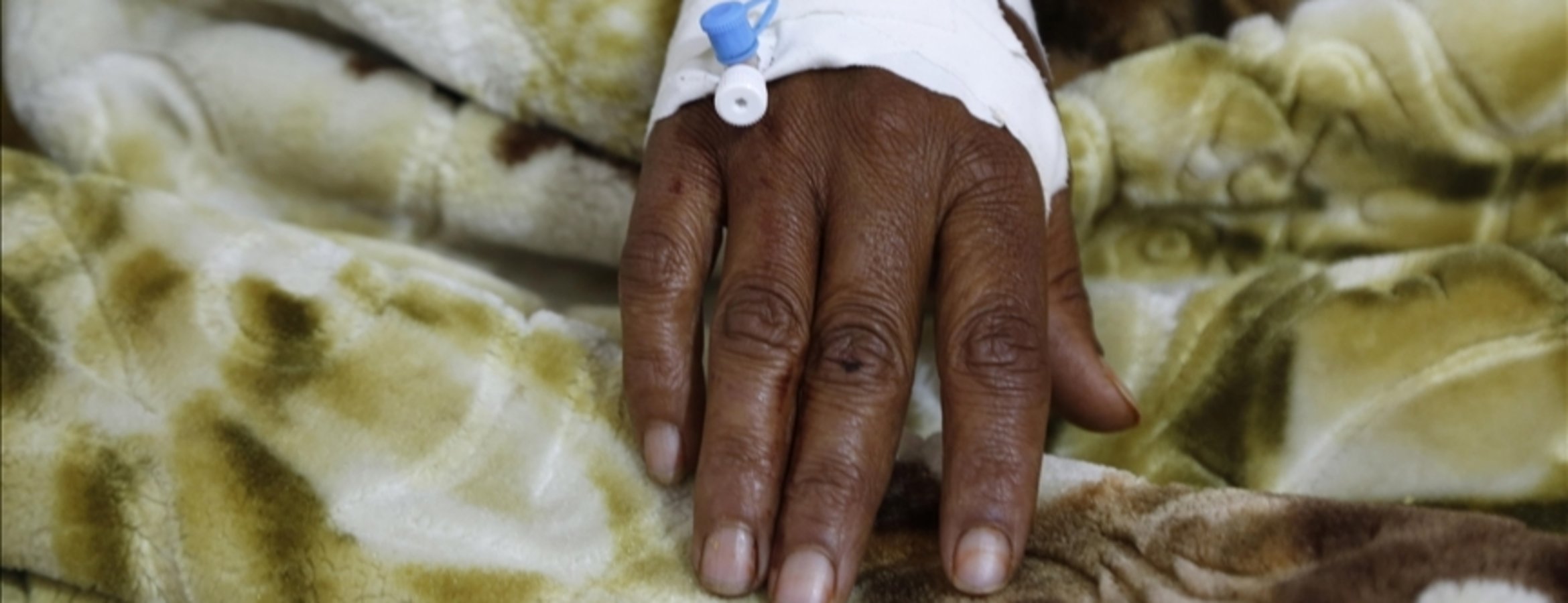 DSÖ: Afrika’da bu yıl 4 bin 200’den fazla kişi kolera nedeniyle hayatını kaybetti
