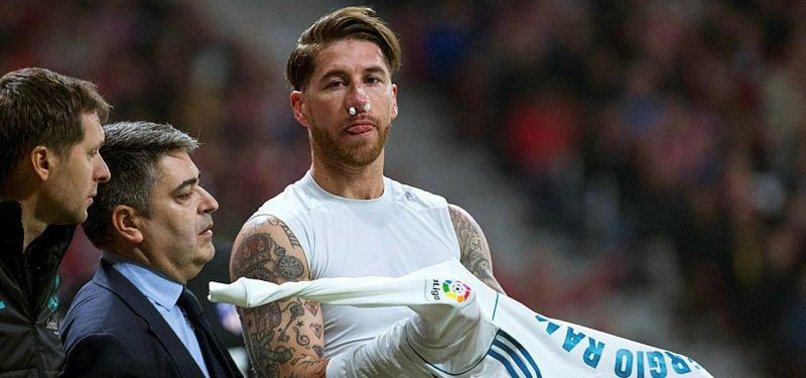 REAL MADRID CONFIRM RAMOS NOSE BREAK