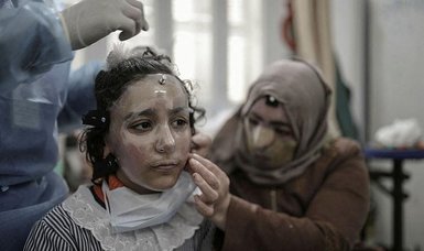 Gaza girl dons 3D-printed mask to heal burnt face