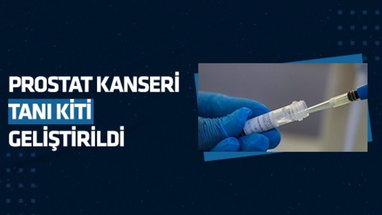 Van’da idrardan prostat kanserini tespit eden tanı kiti geliştirildi
