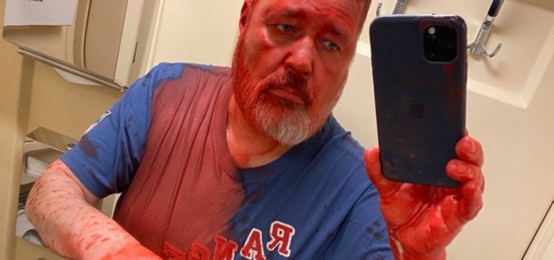 NOBEL PEACE PRIZE WINNER ATTACKED WITH RED PAINT ON TRAIN IN RUSSIA