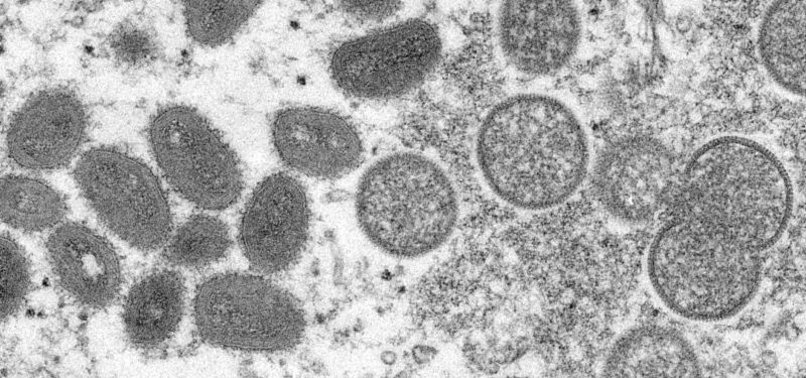 UK RECORDS 77 MORE CASES OF MONKEYPOX