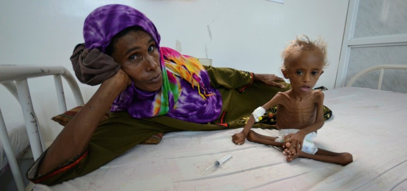WORLD WILL SEE LARGEST FAMINE IN DECADES IF SAUDI BLOCKADE NOT LIFTED IN YEMEN, UN WARNS