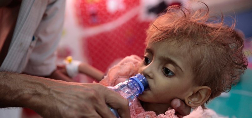 WHO PROVIDES AID TO FIGHT CHILD MALNUTRITION IN YEMEN