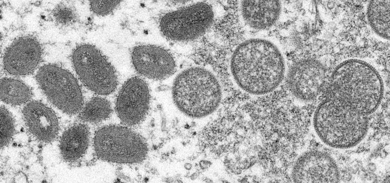 WHO experts discuss whether to declare emergency on monkeypox