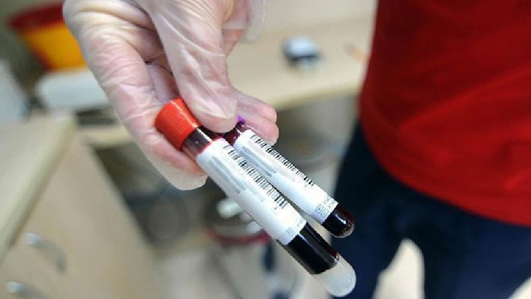 Kanserle mücadelenin yeni silahı: kan testleri