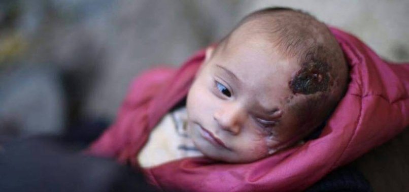 SYRIAN WAR BABY VICTIM BECOMES SYMBOL OF RESISTANCE