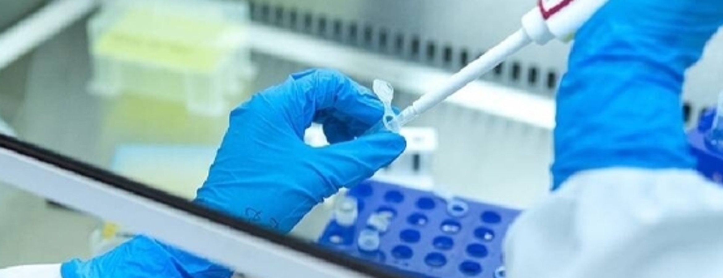 Araştırmaya göre, kansere yakalanma riski doğmadan önce başlayabiliyor