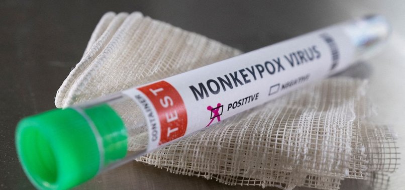 BRAZIL HEALTH OFFICIALS AWAIT TEST RESULTS TO CONFIRM FIRST MONKEYPOX CASE
