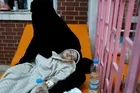 Yemen insani krizin eşiğine geldi