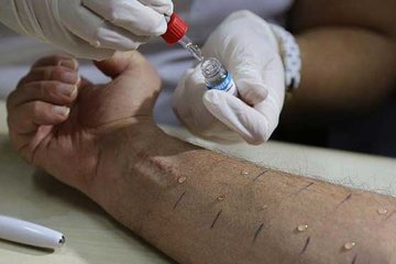 Besin alerjileri ölümcül olabilir
