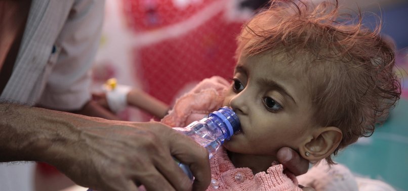 8 MILLION YEMENI CHILDREN LACK ACCESS TO DRINKING WATER: UN
