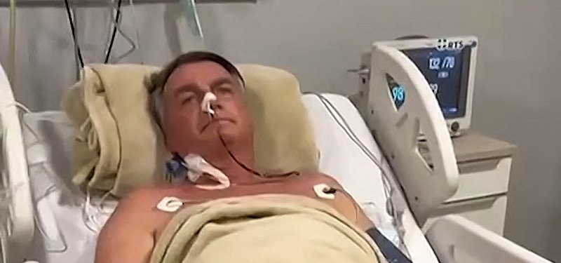 Bolsonaro undergoes surgery after being hospitalized