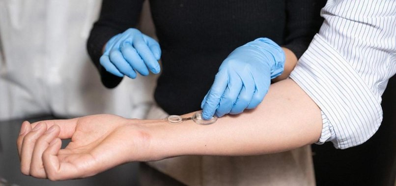 CALTECH DEVELOPS SMART BANDAGE FOR EARLY INFECTION DETECTION